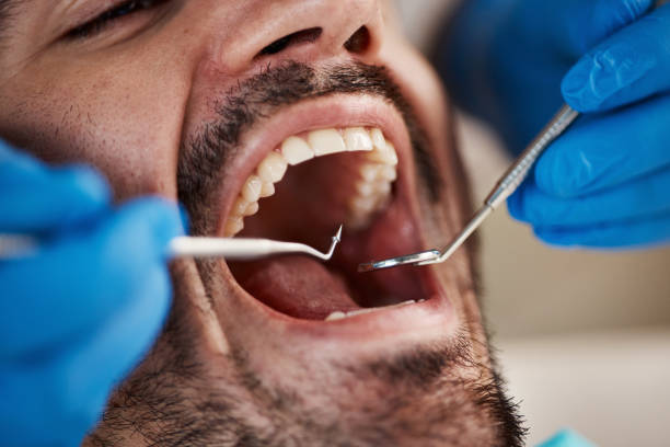 Best Emergency Dental Care for Sports Injuries in Nicholasville, KY